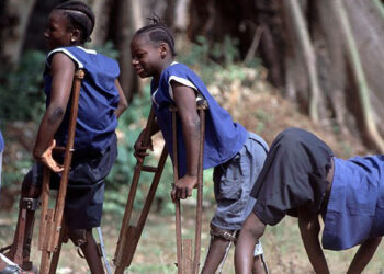 International Day of People With Disabilities Personal Reflections on Growing up With Polio