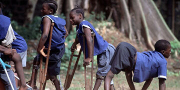 International Day of People With Disabilities Personal Reflections on Growing up With Polio