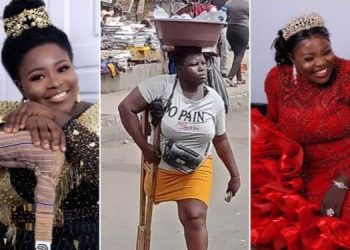 ‘She Lied, She Is Not An Orphan’ – Lagos State Hands Over Amputee To Police Over Untrue Stories