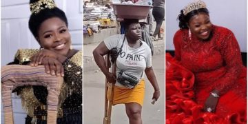 ‘She Lied, She Is Not An Orphan’ – Lagos State Hands Over Amputee To Police Over Untrue Stories
