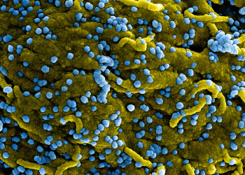 Marburg Virus, An Ebola-Like Virus Resurfaces