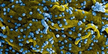 Marburg Virus, An Ebola-Like Virus Resurfaces