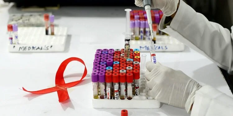 American Woman Cured Of HIV Using New Treatment