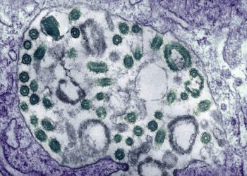 WHO: Ghana Reports Two Suspected Cases Of Marburg Virus