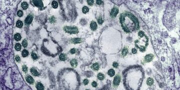 WHO: Ghana Reports Two Suspected Cases Of Marburg Virus