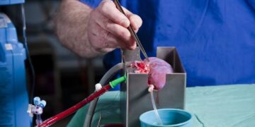 Researchers Alter Blood Type Of Donor Kidney In Transplant Breakthrough