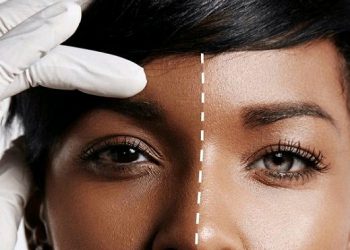 Cameroon Bans Skin-Whitening Products