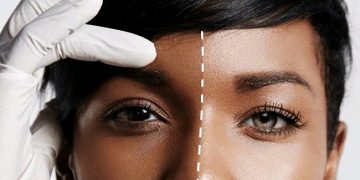 Cameroon Bans Skin-Whitening Products