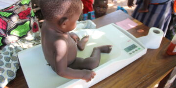 Malawi: Over Half A Million Children Risk Malnutrition – UNICEF