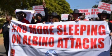 Malawi: People With Albinism Demand End To Attacks On Community