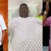 Nigerian Comic Actor, 'Mr Ibu' Undergoes Leg Amputation Surgery Amid Health Battle