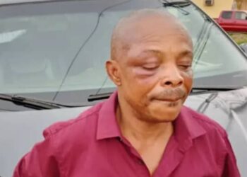 Nigeria: Labour Congress Leader To Be Flown Abroad After Brutalisation