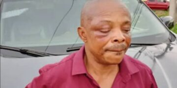Nigeria: Labour Congress Leader To Be Flown Abroad After Brutalisation