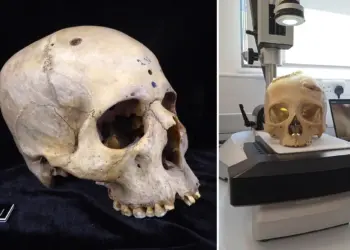 4,000-Year-Old Egyptian Skull Provides Clues To Historical Cancer Treatments