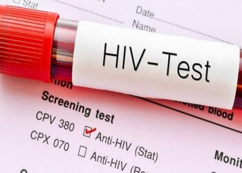 Ghana: 17,774 People Tested Positive For HIV In 2023