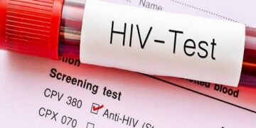 Ghana: 17,774 People Tested Positive For HIV In 2023