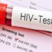Ghana: 17,774 People Tested Positive For HIV In 2023