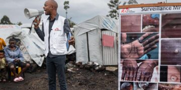 Healthcare Crisis In DR Congo As 500 Mpox Patients Flee Rebel-Hit Clinics