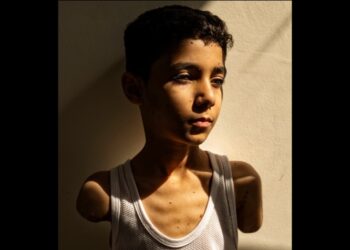 Wounded Palestinian Boy’s Portrait Wins Press Photo Of The Year