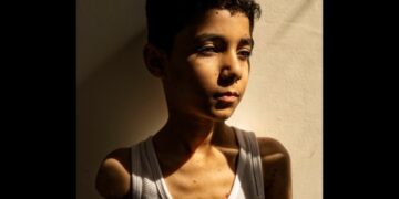 Wounded Palestinian Boy’s Portrait Wins Press Photo Of The Year