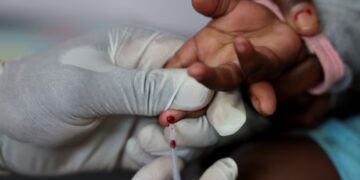 China To Commit $3.5m In South Africa’s HIV Response
