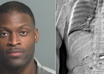 US: Man Who Stole, Swallowed $760,000 Worth Of Jewellery Awaits Sentencing