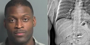 US: Man Who Stole, Swallowed $760,000 Worth Of Jewellery Awaits Sentencing